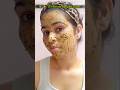 🌿✨ Pimples Gone in 10 Minutes! 😱🔥#skincare #diy #diyremedies #foryou #shorts #viralhacks #glowup