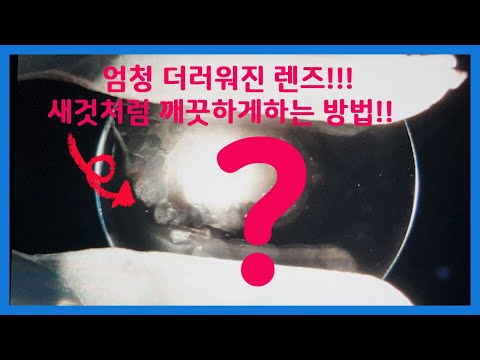   드림렌즈세척 하드렌즈세척 더러운렌즈 새것처럼 만들 수 있다