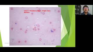 Trinity Blood Solutions: From Theory to Practice in Hematology