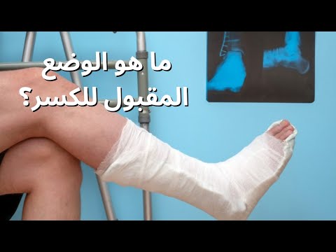 فيديو: لماذا يقول المسيرون كسر ساق؟