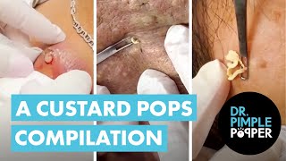 A Custard Pops Compilation 💥