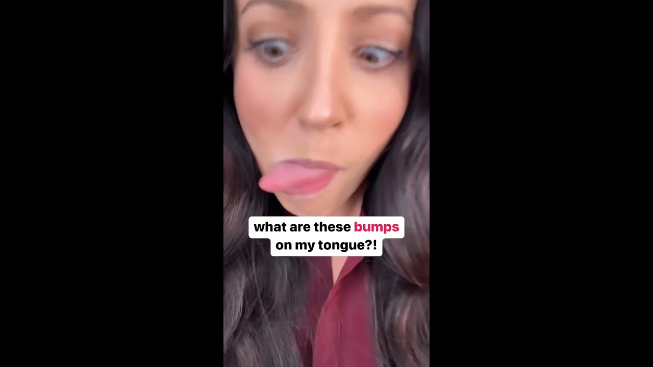 Bumps On Your Tongue Shorts