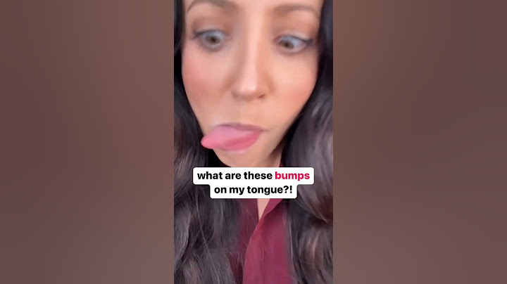 bumps on your tongue? 👅 #shorts
