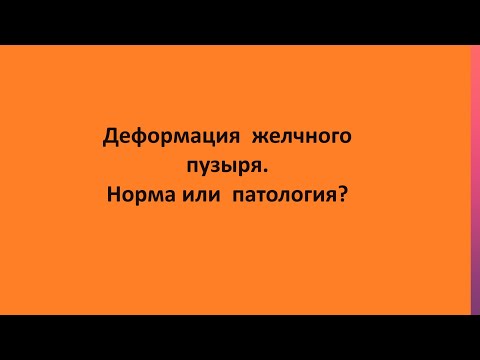 Деформация  желчного пузыря. Норма или  патология?