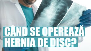 Când se operează hernia de disc și când nu este necesară operația?