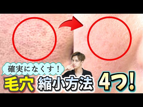 【黒ずみ】毛穴を小さくする４つの方法! How to cure enlarged pores and blackhead