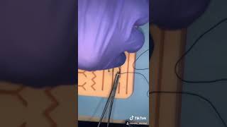 How to do a Simple Interrupted Suture