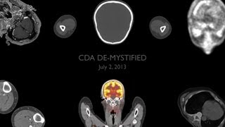 CDA De-mystified OTech Google Hangout July 2 2013