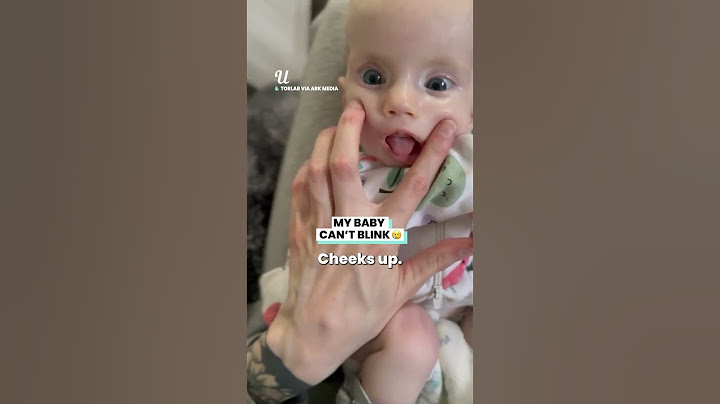 My Baby Can't Blink#viralvideo #babies #parenting #viral