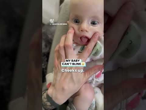 My Baby Can T Blink Viralvideo Babies Parenting Viral