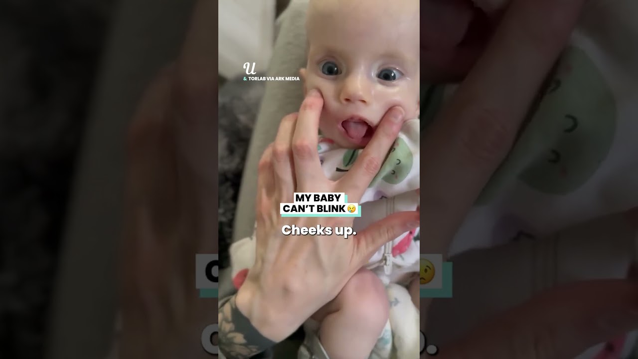My Baby Can't Blink
