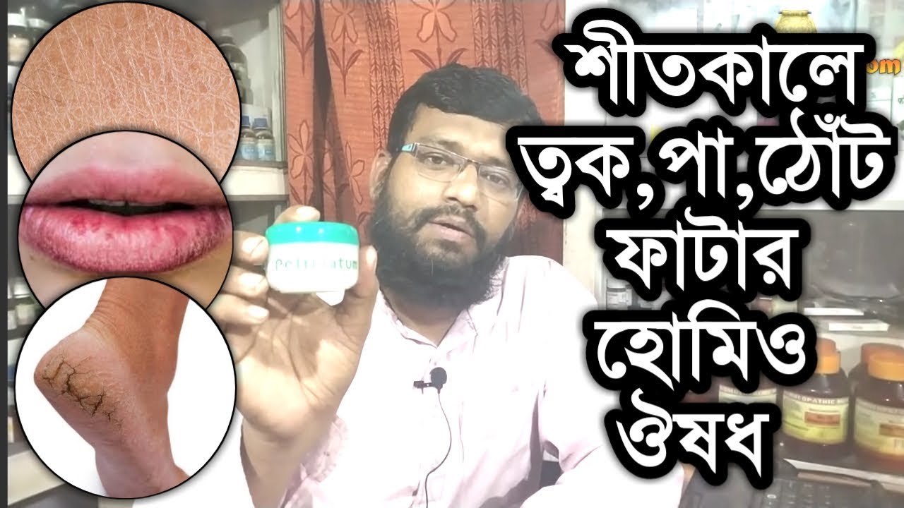 শীতে শুষ্ক ত্বক হাত পা ও ঠোঁঁট ফাটার হোমিওপ্যাথি ঔষধ | Dry Skin in Winter Homeopathy treatment