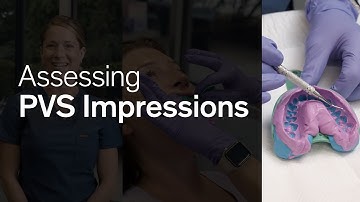 How to Assess PVS Impressions | Smilers® Aligners