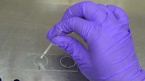 Coagulase test for Staphylococcus aureus