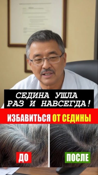 ЧУДО СРЕДСТВО ОТ СЕДИНЫ! СЕДИНА УШЛА РАЗ И НАВСЕГДА! - YouTube