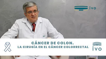 ¿Cuánto tiempo se puede vivir con un tumor de colon?