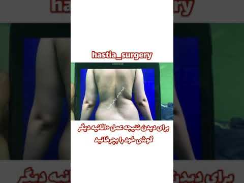 پیکر تراشی و زیبایی اندام 