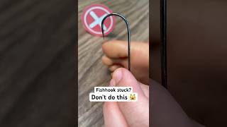 Fishhook Stuck In Your Foot? Try This