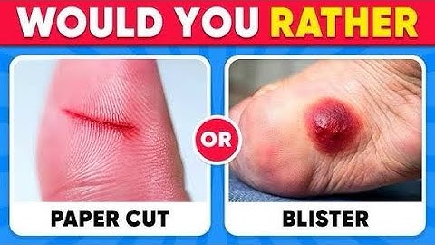Would You Rather Extreme Edition 🥵🤯 | 50 Brutal Challenge Questions That’ll Break Your Brain!