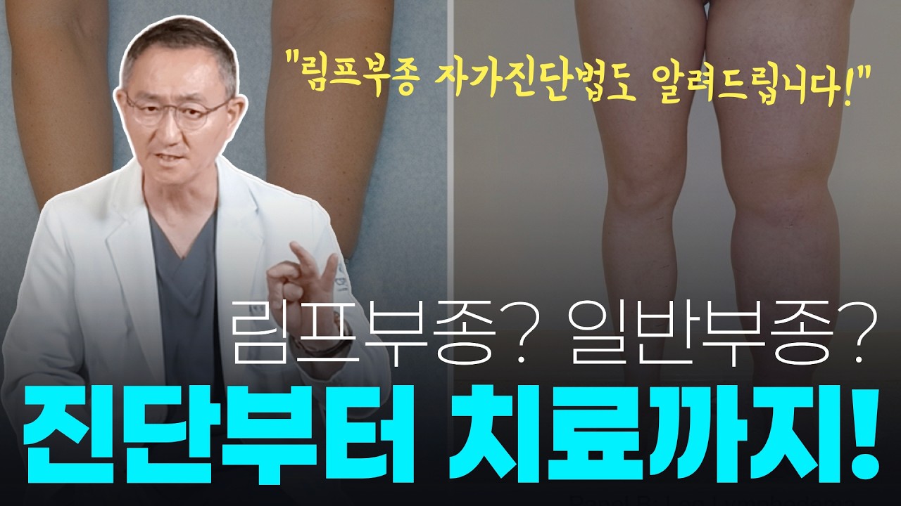 림프부종 자가진단법과 붓기 싹 없애는 운동, 치료법!
