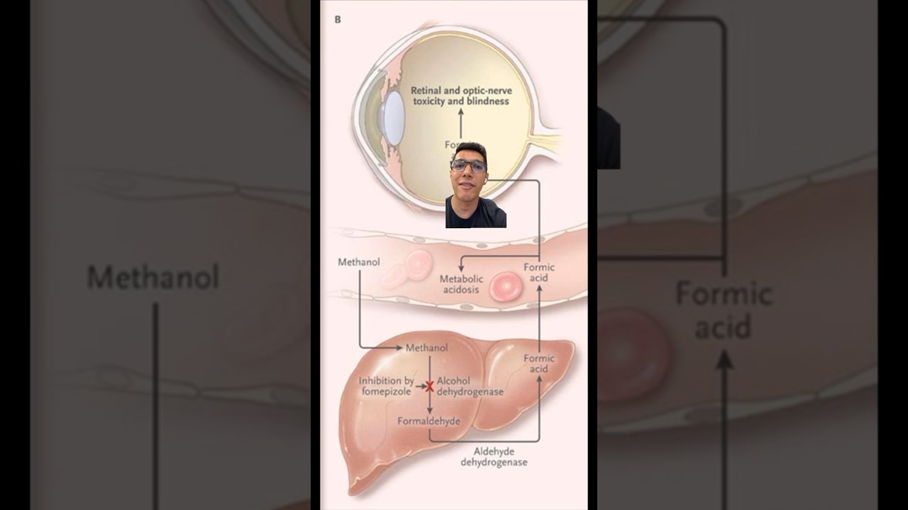 Some alcohol can make you go BLIND