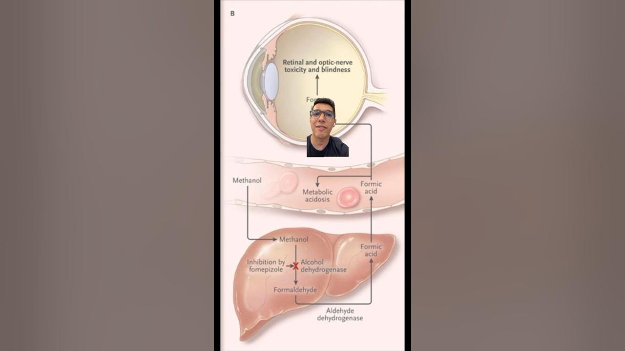 Some alcohol can make you go BLIND YouTube