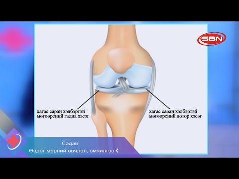 Видео: Нохойн коньюнктивит: оношлогоо ба эмчилгээ
