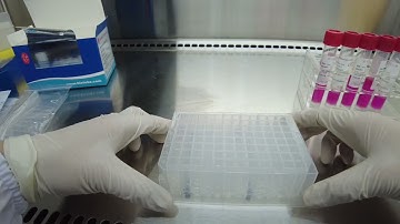 Automated 32 flux nucleic acid extraction system work with BioTeke kits