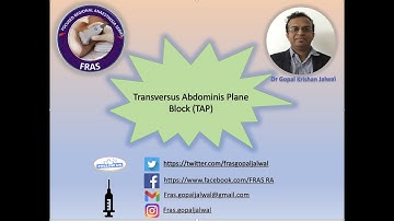 TAP BLOCK, TRANSVERSUS ABDOMINIS PLANE BLOCK