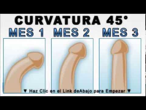 La operación en el miembro