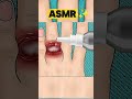 ASMR Treatment #asmr #ukdoctor #SatisfyingVideo #viraltiktok #relaxingvideos