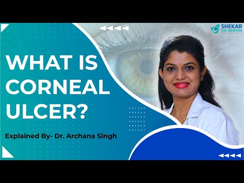 What is a Corneal Ulcer? | Symptoms, Causes, Diagnosis &amp; Treatment | Shekar Eye Hospital