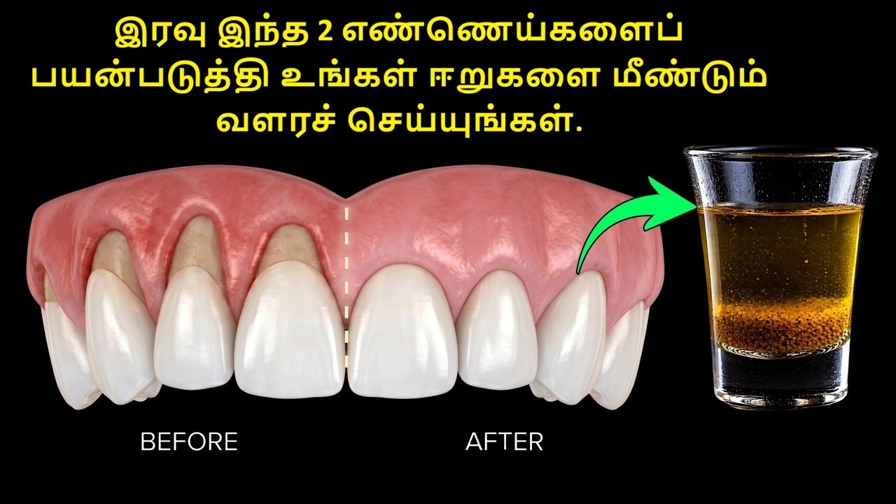 இரவு இந்த 2 எண்ணெய்களைப் பயன்படுத்தி உங்கள் ஈறுகளை மீண்டும் வளரச் செய்யுங்கள் | Regrow your gum