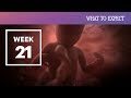 21 Weeks Pregnant - What to Expect Your 21st Week of Pregnancy