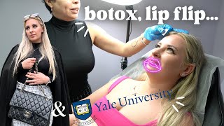 botox, lip filler + yale university