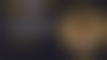 Wiroc Global 2022 : Open Procedure in a Stiff = Elbow - Takuro Wada