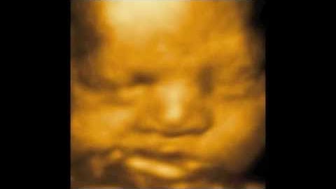 3D 4D Ultrasound by 1st Glimpse Inc. 3D/4D Ultrasound in Brooklyn New York
