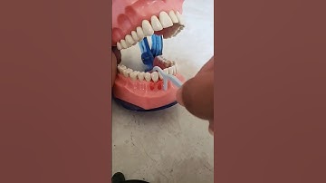 Does your gums bleed while flossing? #shorts #trendingshorts #flossing #dentalartistry
