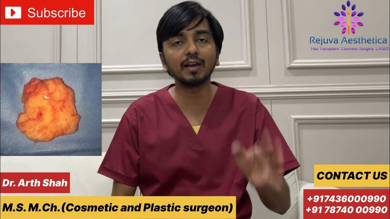 How does looks like ? How to know if you have