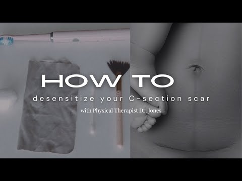 How to Desensitize your C-section Scar (Reduce Numbness & Pain)