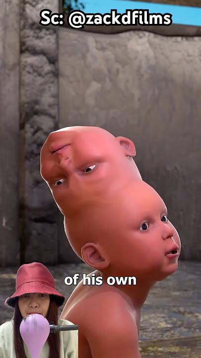 This Child Has Two Heads #facts 35 #uniquefacts #remix
