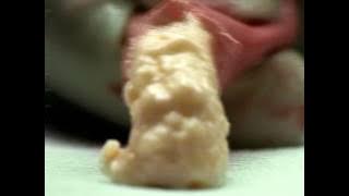 Setiap Rokok Merusak Kesehatan Anda - Aorta