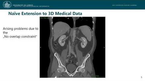 Self-Supervised 3D Context Feature Learning on Unlabeled Volume Data