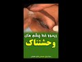 ریمو خط چشم های وحشتناک ریمو خط چشم های وحشتناک