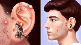 Asmr Ear Cleaning Animation | Asmr Animation Removal Of Maggot And Dog Ticks From Ear... Use 🎧 Part1