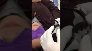 wraparound retainer adjustment