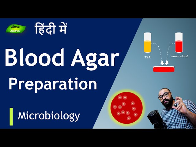 4 blood agar and hemolysis and mac-conkey.ppt