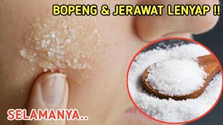 Jerawat dan Bopeng Lenyap hanya dg Garam •| Begini tipsnya