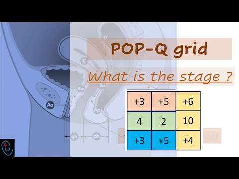 POP-Q grid explained