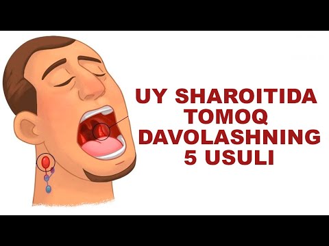 Video: Tomoqning qichishishidan qutulishning 3 usuli